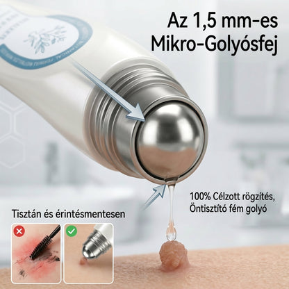 Officiële merkshop | 🖊️Natravor® 7-daagse wratten- en vlekkenverwijderaar (pijnstillende applicator voor nauwkeurig aanbrengen, laat geen littekens achter)🌳